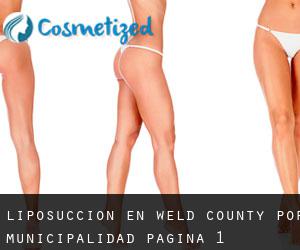 Liposucción en Weld County por municipalidad - página 1