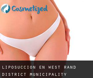 Liposucción en West Rand District Municipality