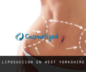 Liposucción en West Yorkshire