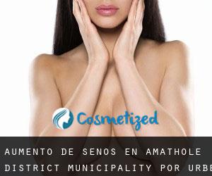 Aumento de Senos en Amathole District Municipality por urbe - página 1