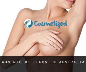 Aumento de Senos en Australia Aumento de Senos en Australia