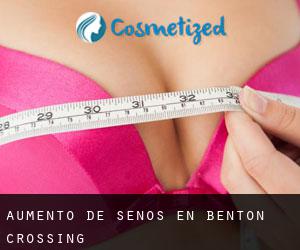 Aumento de Senos en Benton Crossing