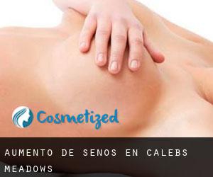 Aumento de Senos en Calebs Meadows