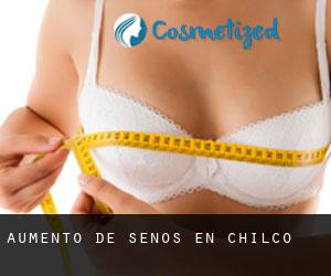 Aumento de Senos en Chilco
