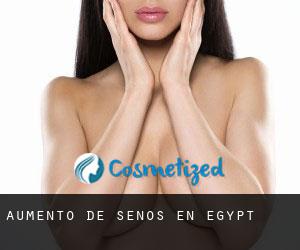 Aumento de Senos en Egypt
