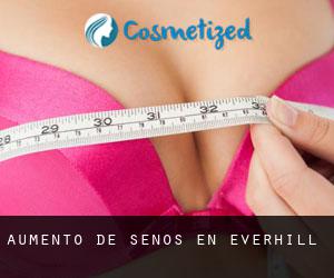 Aumento de Senos en Everhill