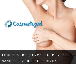 Aumento de Senos en Municipio Manuel Ezequiel Bruzual