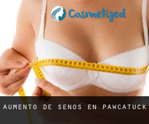 Aumento de Senos en Pawcatuck Aumento de Senos en Pawcatuck
