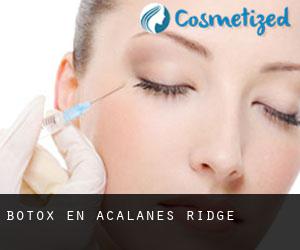 Botox en Acalanes Ridge