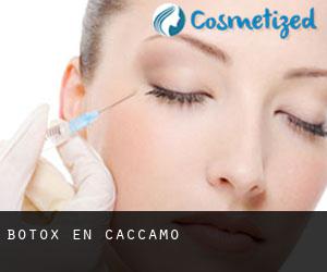 Botox en Caccamo
