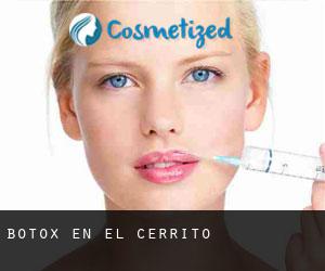 Botox en El Cerrito