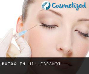 Botox en Hillebrandt