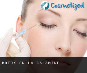 Botox en La Calamine