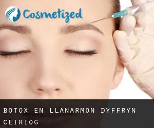 Botox en Llanarmon Dyffryn-Ceiriog