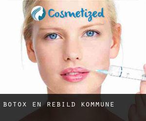 Botox en Rebild Kommune