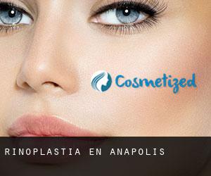 Rinoplastia en Anápolis