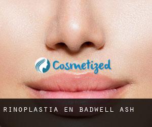 Rinoplastia en Badwell Ash