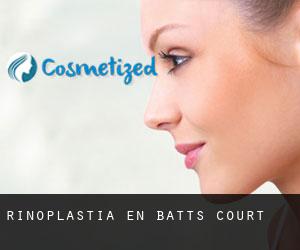 Rinoplastia en Batts Court
