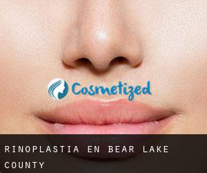 Rinoplastia en Bear Lake County