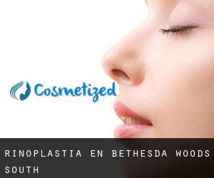 Rinoplastia en Bethesda Woods South