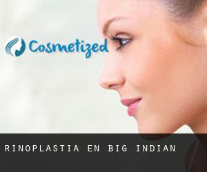 Rinoplastia en Big Indian