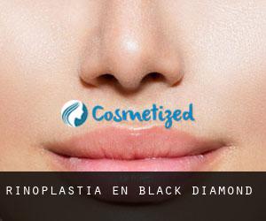 Rinoplastia en Black Diamond