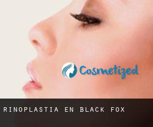Rinoplastia en Black Fox