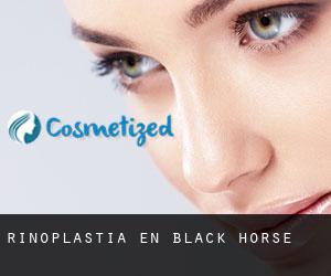 Rinoplastia en Black Horse