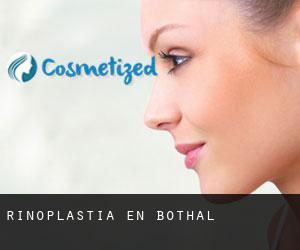 Rinoplastia en Bothal