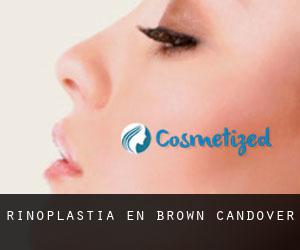 Rinoplastia en Brown Candover