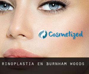 Rinoplastia en Burnham Woods