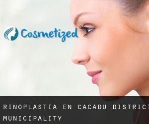 Rinoplastia en Cacadu District Municipality