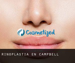 Rinoplastia en Campbell