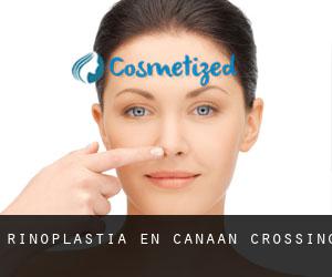 Rinoplastia en Canaan Crossing