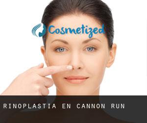 Rinoplastia en Cannon Run
