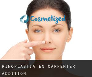 Rinoplastia en Carpenter Addition