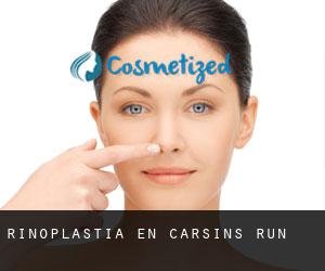 Rinoplastia en Carsins Run