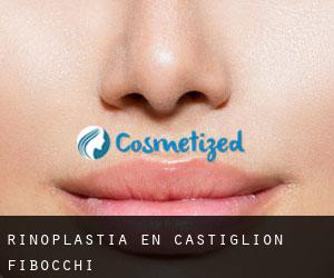 Rinoplastia en Castiglion Fibocchi