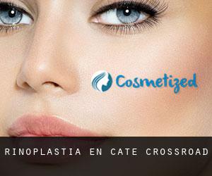 Rinoplastia en Cate crossroad