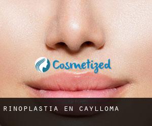 Rinoplastia en Caylloma