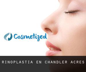 Rinoplastia en Chandler Acres