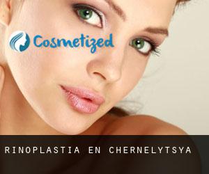 Rinoplastia en Chernelytsya