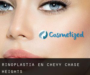 Rinoplastia en Chevy Chase Heights
