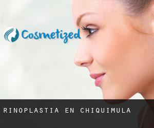 Rinoplastia en Chiquimula