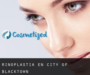 Rinoplastia en City of Blacktown