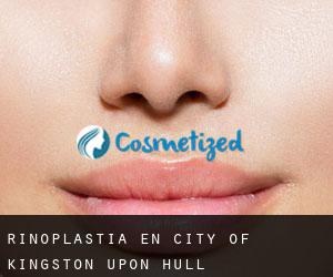 Rinoplastia en City of Kingston upon Hull
