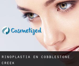 Rinoplastia en Cobblestone Creek