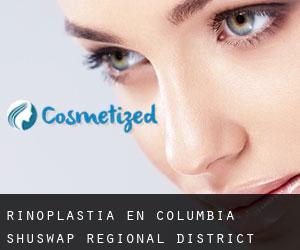 Rinoplastia en Columbia-Shuswap Regional District