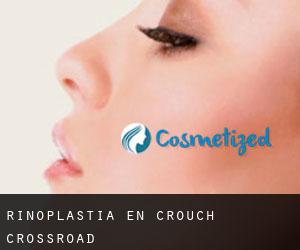 Rinoplastia en Crouch Crossroad
