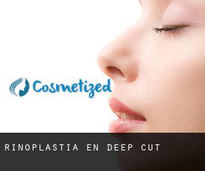 Rinoplastia en Deep Cut